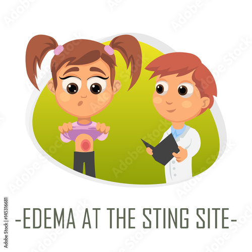 Edema at the sting site medical concept. Vector illustration.