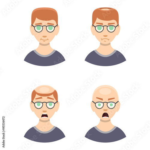 Information chart of hair loss stages types of baldness illustrated on male head vector.
