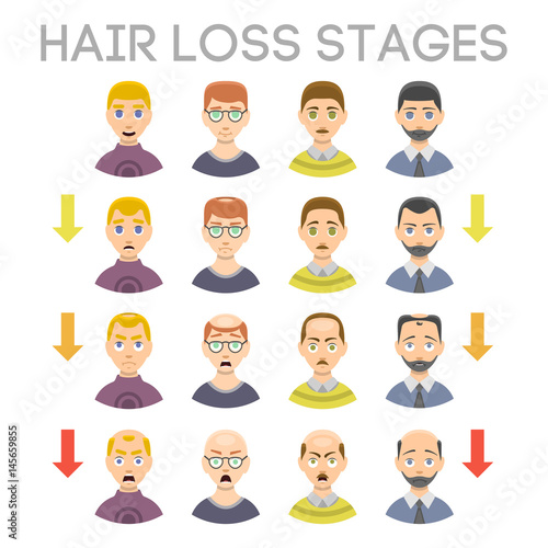 Information chart of hair loss stages types of baldness illustrated on male head vector.