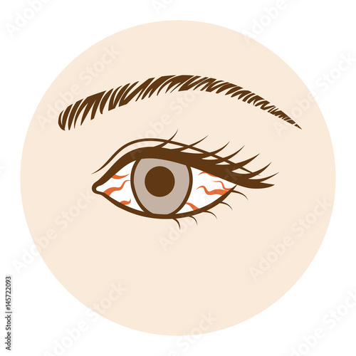Conjunctivitis Eye -Body part, Front view 
結膜炎　ボディパーツ　正面