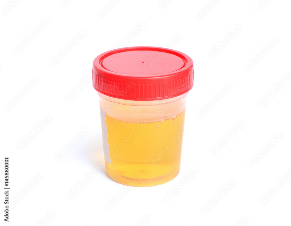 Container with urine for analysis. Isolated.. Container with urine for analysis. Isolated..