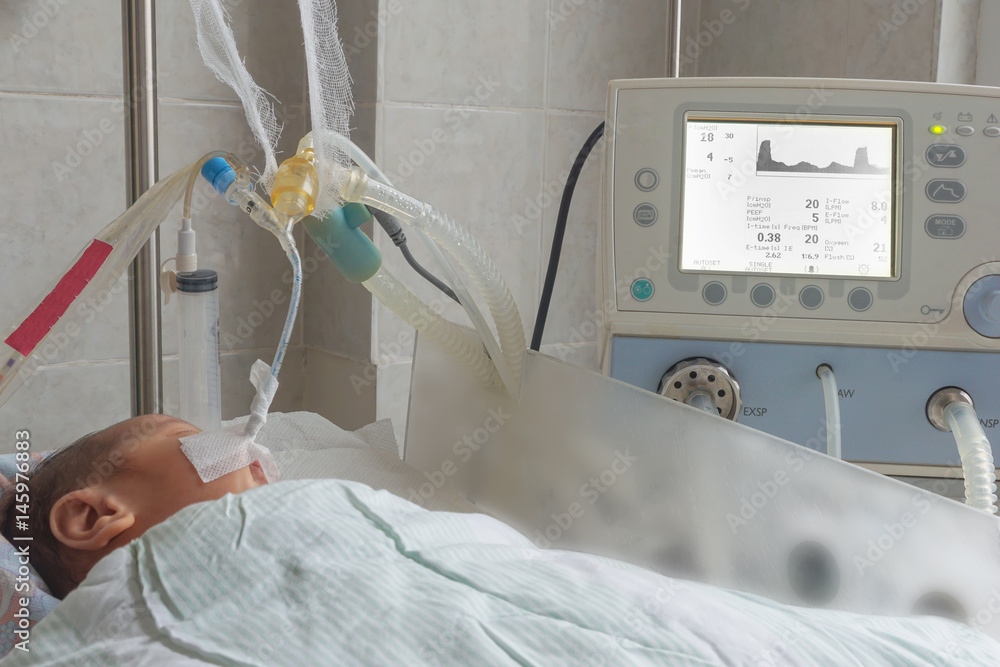 Newborn baby on breathing machine in neonatal intensive care unit Stock