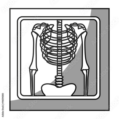 grayscale square frame shading with chest radiography vector illustration