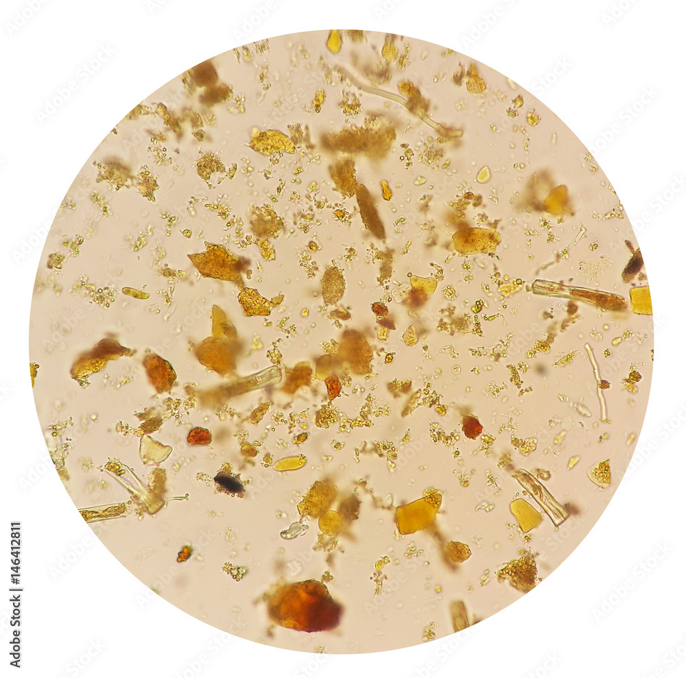 Stool parasites examination test for parasites or eggs in a stool sample  with iodine stained under microscope.The parasites are associated with  intestinal infections. Stock Photo | Adobe Stock