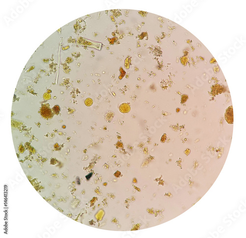 White Parasites In Stool