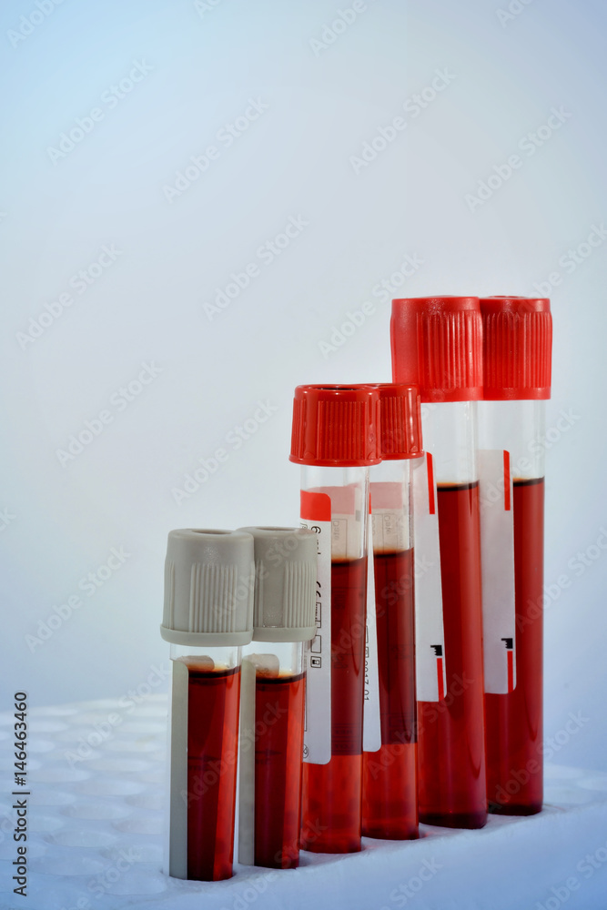 Tubes blood sample in rack.(blue tone) Tubes blood sample in rack.(blue tone)