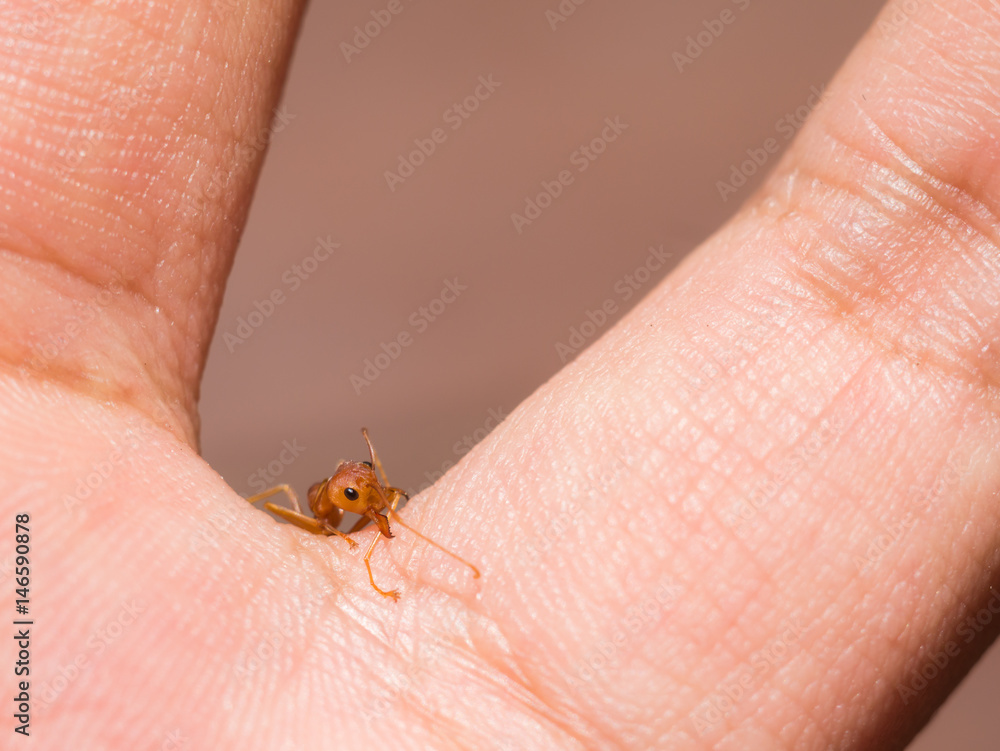 Closeup red ant bite man hand Closeup red ant bite man hand