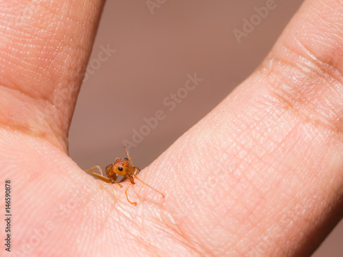 Closeup red ant bite man hand