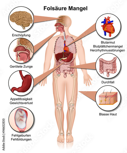 Vitamin B7 Mangel Anzeichen und Symptome, vektor illustration, Biotin