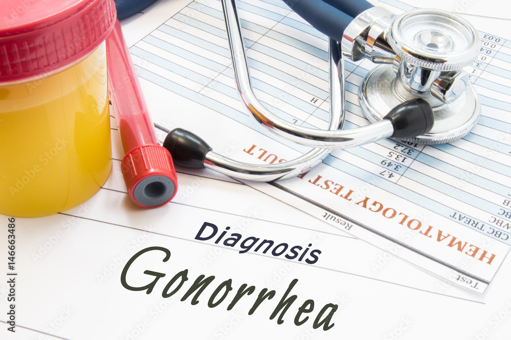 Diagnosis Gonorrhea. Stethoscope, laboratory test tube with blood