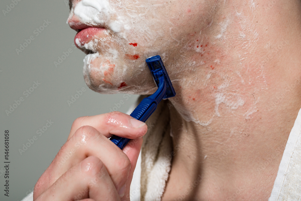 Fototapeta premium Man with towel in front of mirror shaves his beard. Blue disposable razor and sensitive men's skin on the face after the beard. Blood on the face of razor