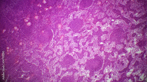 Lymph node section under the microscope photo
