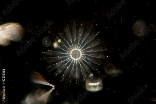 Chaetoceros (Diatom) under microscope view. photo