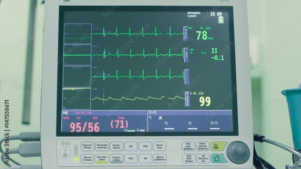 The monitor a patient in the operating room The monitor a patient in the operating room