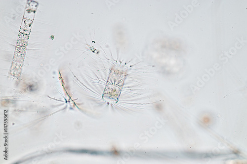 Chaetoceros (Diatom) under microscope view. photo