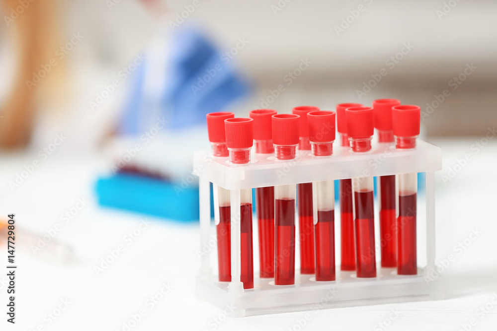 Test tubes with blood in laboratory on blurred background Test tubes with blood in laboratory on blurred background