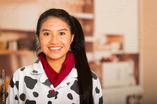 Картината върху платно Portrait of happy young girl with skin problem