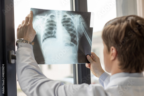 doctor holding X-ray