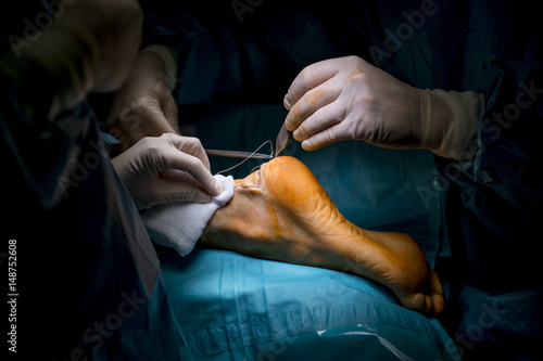 Surgeons doing an achilles tendon surgery in hospital photo