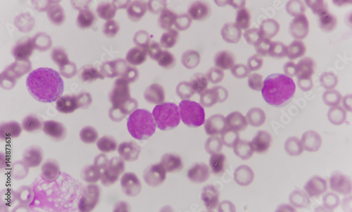 blood smear is often used as a follow-up test