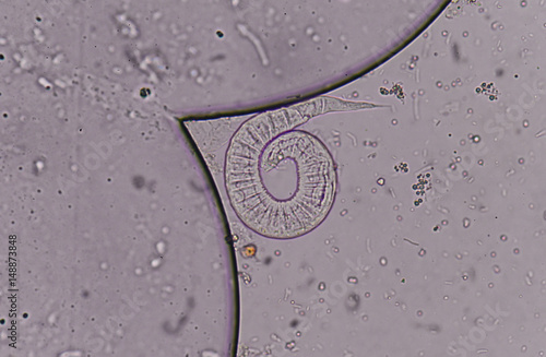  strongyloides in stool exam photo