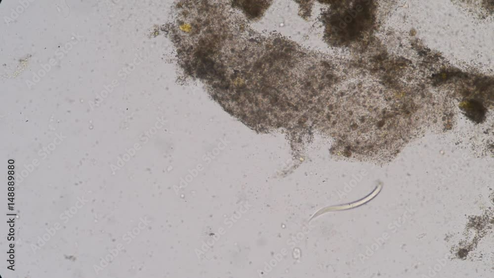Threadworm Stool Sample Moment of Strongyloides stercoralis (threadworm) in stool, analyze by ...