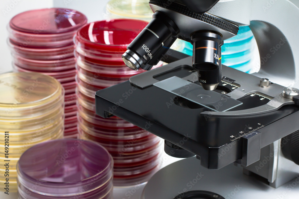 petri dishes samples for analysis in microscope in the laboratory ...