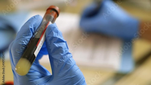 extreme closeup of test tube of blood taken for a blood test photo