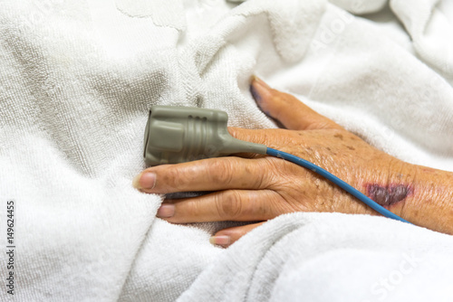 Patient in the hospital with pulse gauge on finger
