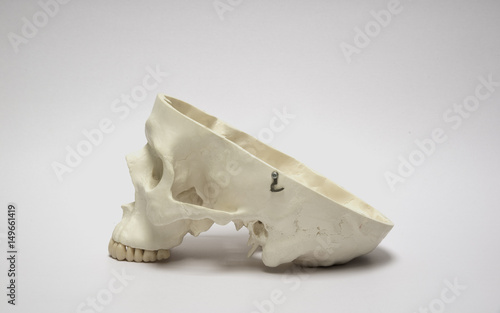 Artificial human skull model