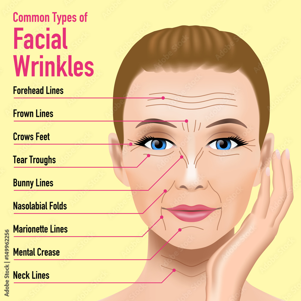 Common Types Of Facial Wrinkles Cosmetic Surgery Woman Facial 