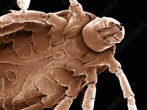 Ventral surface of a dog tick (Acari: Dermacentor sp.) imaged in a scanning electron microscope photo