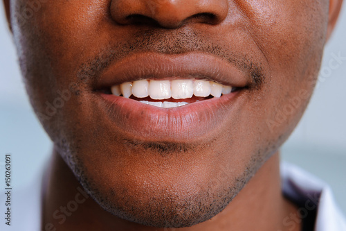 White teeth smile black man close up