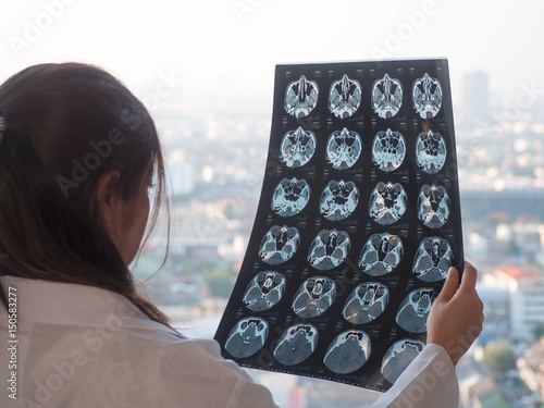 The doctor watching a patient x-ray in hospital near window