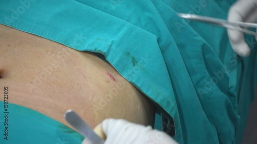 The doctor is suture the wounds to the patient.