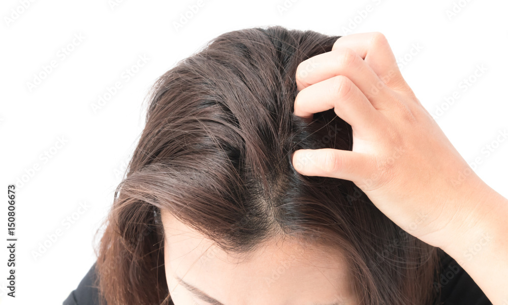 Closeup woman hand itchy scalp, Hair care concept Closeup woman hand itchy scalp, Hair care concept