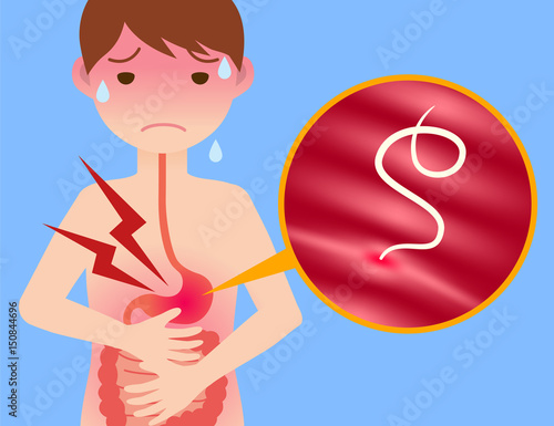 parasitic worm and food poisoning. anisakis. anisakiasis.