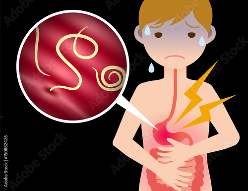 parasitic worm and food poisoning. anisakis. anisakiasis.
