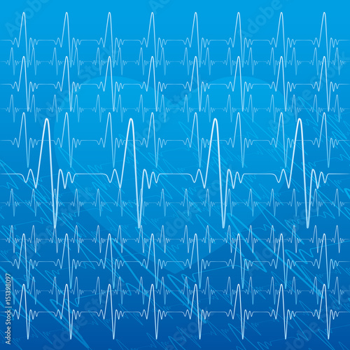 Medical illustration of heartbeat.