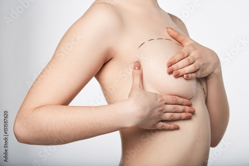 Surgery dotted line on body breast photo