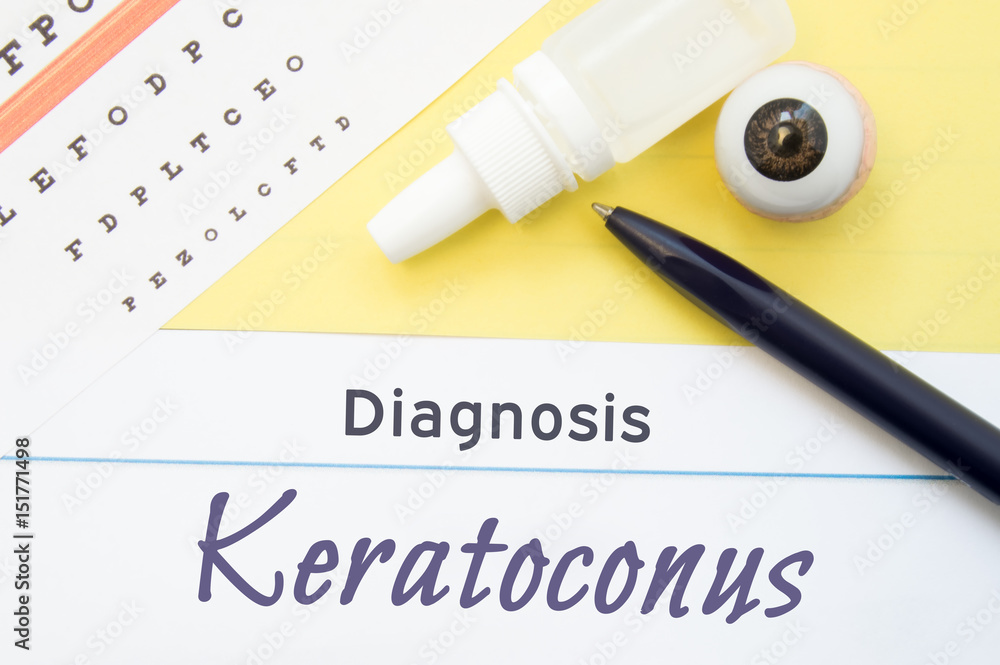 Chart for testing visual acuity, eye drops and eye anatomical model