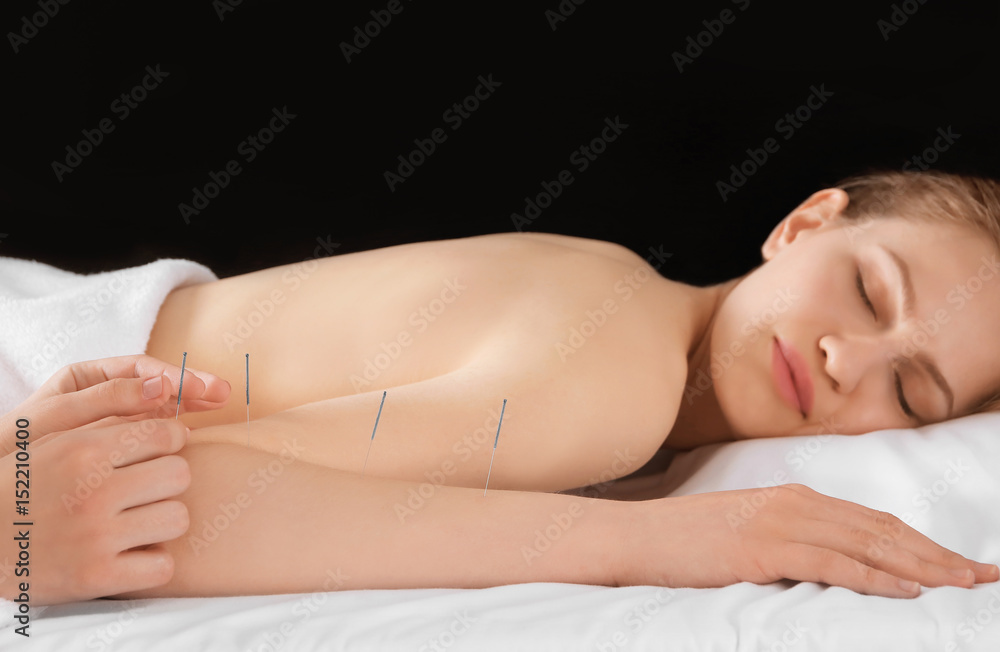 Young woman undergoing acupuncture treatment in salon Young woman undergoing acupuncture treatment in salon