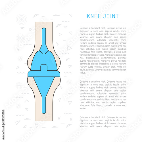 Treatment and prosthetics of the knee joint, Medical illustration in vector isolated on white background