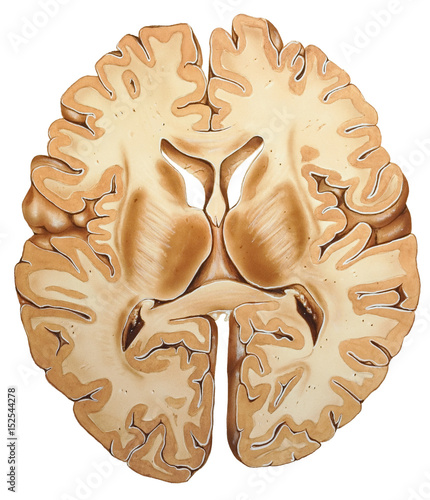 Shown is the cerebral cortex, which is the deeply convoluted surface region of the brain that is most strongly linked to intelligence..