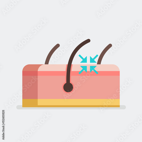 Skin vector illustration