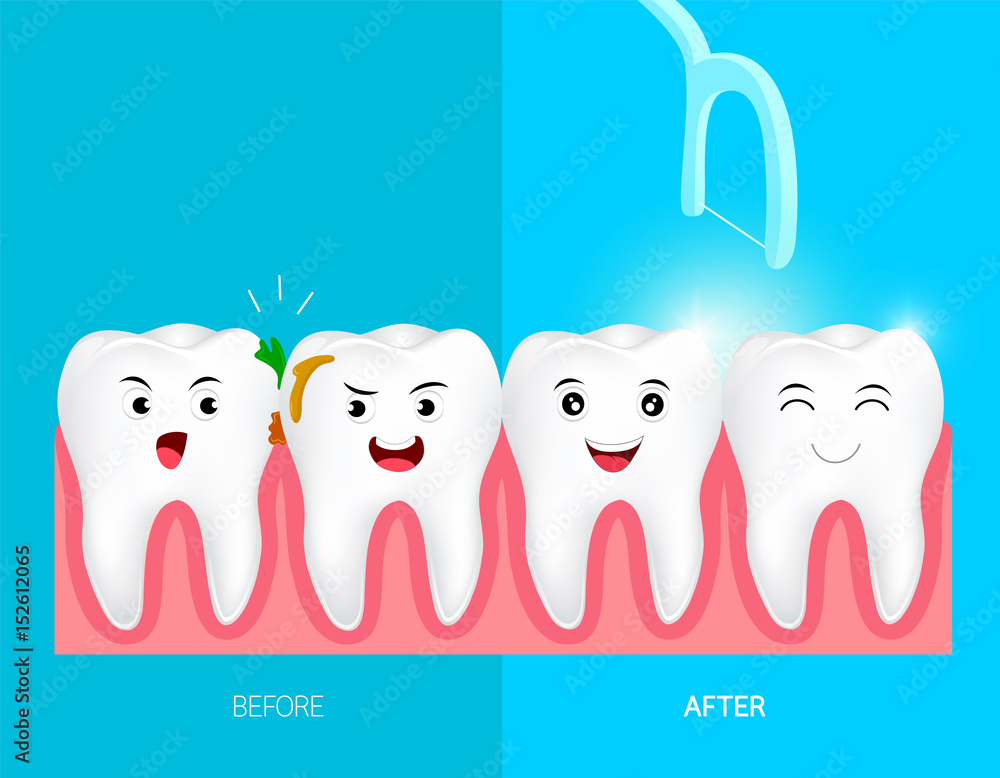 Teeth with dental floss for health care. Before and after, dental care  concept. Cute cartoon tooth character. Deep cleaning, clearing tooth  process. illustration on blue background. Stock Vector | Adobe Stock