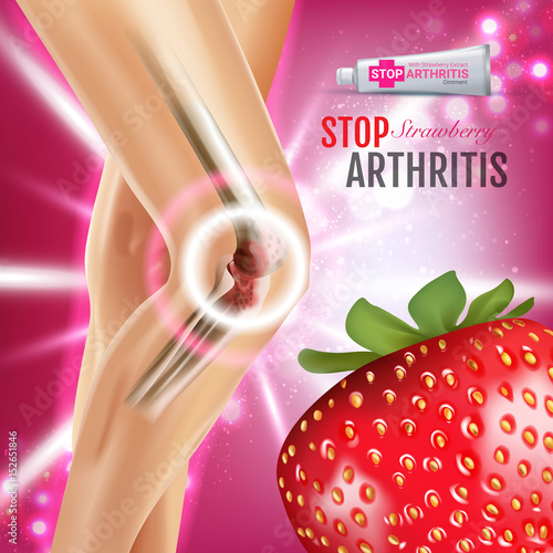 Arthritis Pain Relief Ointment ads. Vector 3d Illustration with Tube cream with strawberry extract.
