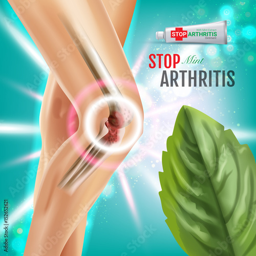 Arthritis Pain Relief Ointment ads. Vector 3d Illustration with Tube cream with peppermint extract.