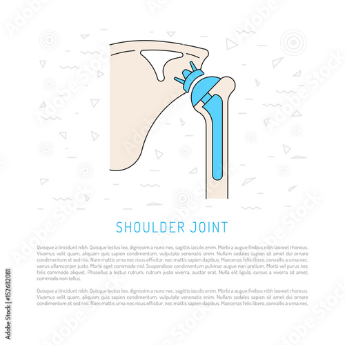 Shoulder prosthesis, vector banner with place for text. Medical illustration
