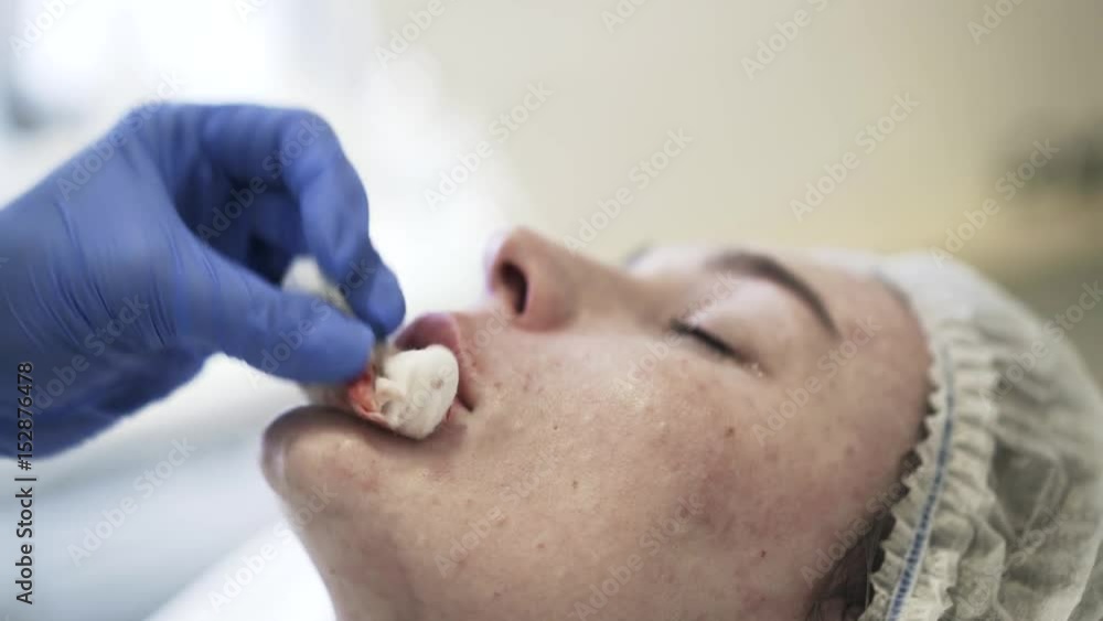 Close up of cosmetician s hands doing a lower lip injeciton to her client lying on the table. Handheld real time close up shot Close up of cosmetician s hands doing a lower lip injeciton to her client lying on the table. Handheld real time close up shot